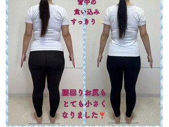 ダイエット ハピアス(HAPIAS)/