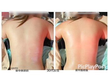 フィットジユウガオカ(Fit_Jiyugaoka)/背中も締まる(インディバ/痩/身)