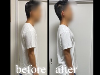 サンクエール 代官山鍼灸院(CINQ AILES)/矯正　猫背・ストレートネック