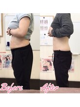 整体院 トトノウ(TotonoU)/ダイエットやエステもできる！！