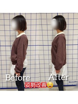 サロンリーベ(salon reve)/20代女性／反り腰でお悩み！