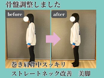 シェノン(Chainon)/骨盤矯正