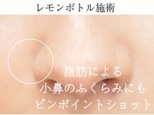 ヌナ(NOONA)/脂肪によるふくらみにも[小顔]