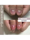 深爪矯正長さ出しワンカラー