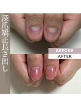 プリンチペッサジゼル/深爪矯正長さ出しワンカラー