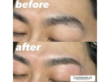 キャンディベース ノースアップ(Candybase North up)/スッキリ！モテ眉に！