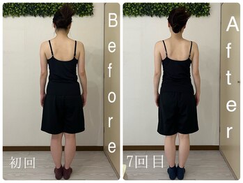 美容整体 綾/背中のお肉付きには