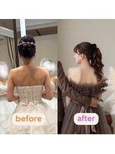 グレフル鍼灸接骨院 整体院 心斎橋/ブライダル/肩甲骨はがし/美鎖骨