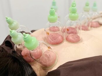 神門整体院 甲東園/カッピングでスッキリ背中!