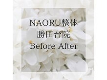 ナオル整体 勝田台院(NAORU整体)/勝田台・姿勢改善・肩こり