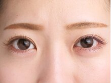 アドノス(Adonos)/