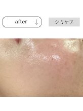 チューズ 北参道 代々木店(CHOOSE)/ナノホワイトセラムを導入♪