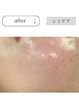 チューズ 北参道 代々木店(CHOOSE)/ナノホワイトセラムを導入♪