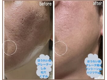 オーロラ 福岡行橋(AURORA)