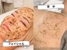 【贅沢全身肌ケア】ハーブピーリング全顔＆背中+フェイシャル毛穴パック