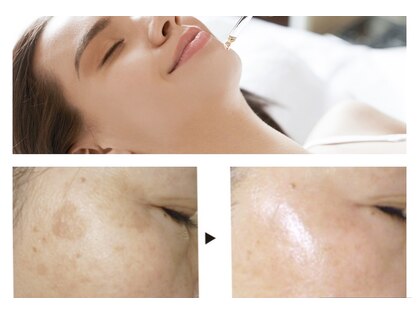 ラパス(Lapaz)の写真