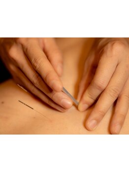鍼灸施術を受けたい