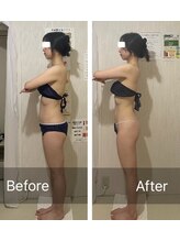 ウツク(utuku)/痩身/ブライダル/長岡市/柏崎市