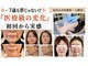 アガルコガオサロン(AGARU KOGAO SALON)の写真