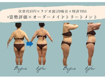 シエル 都立大学(CIEL)/骨格にあわせたデトックス痩身