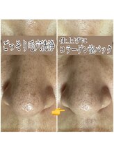 エステルーム クリスタル/ごっそり毛穴洗浄