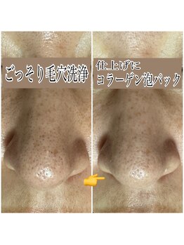 エステルーム クリスタル/ごっそり毛穴洗浄