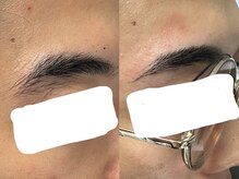 ムーンサン(Moon sun)/美眉ワックス脱毛