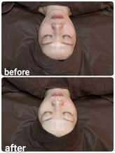 ウララ(ulala)/セラピール1回目