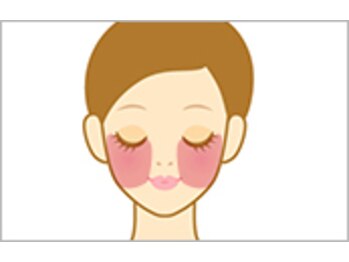 サロン ド フルール/しみ・くすみ改善・美白/マシン