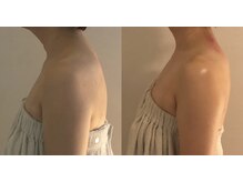 ミルキー(Milky)の雰囲気（一度のお施術でここまで変化できます。）