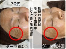 皇漢堂鍼灸療院の雰囲気（シワが気になる方は★最新美容鍼【ダーマ鍼】8/31まで特別価格）
