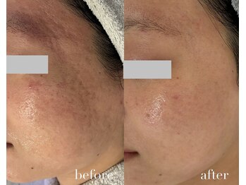 イーサロン(eii salon)/20代女性