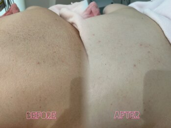 クイーン 渋谷店(QUEEN)/剃るだけでトーンアップ