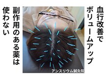 アンスリウム美容整体院 鍼灸院 接骨院の雰囲気(抜けにくくなるからボリュームアップ。自信を取り戻せる。)