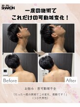 トゥーアズ シャロン(toAZ SHARON)/【鍼灸/首可動域不全】