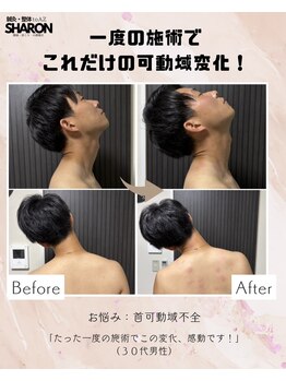 トゥーアズ シャロン(toAZ SHARON)/【鍼灸/首可動域不全】