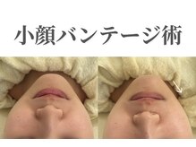 エトレ(etre)/毛穴/くすみ/強炭酸/エステ