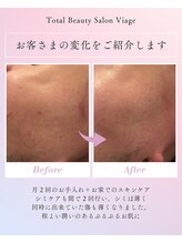 ヴィアージュ(Viage)/