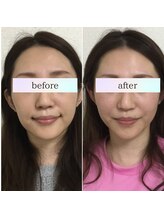 小顔革命 小顔 全身美容矯正専門店/小顔矯正＋顎関節矯正