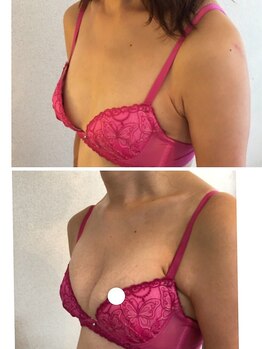 アンド ユー(and.yu)/30代3児/のママ