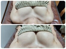 ビープラス(B+)/上:before 　下:after 