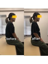 クマモト整骨院/ビフォーアフター