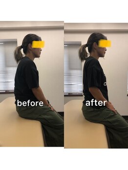 クマモト整骨院/ビフォーアフター