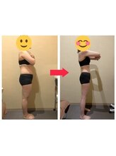 美容整体院元 光の森店/3ヵ月コース　before＆after