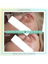 ボーテ ドゥ ランジュ(BEAUTE DE L’ANGE.)/◆アンストレス◆