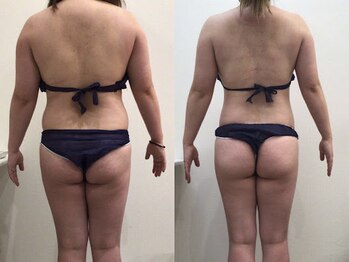 ビラ 銀座店(BILA)/キャビラジ