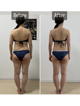 シズク(sizucu)/期間集中ダイエット☆