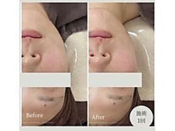 アヤエステティックサロン 綱島店(AYA)/今流行りのあのコース！？