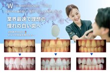 ホワイトニングショップ 三田店