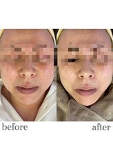 アーク 大河原(Ark)/